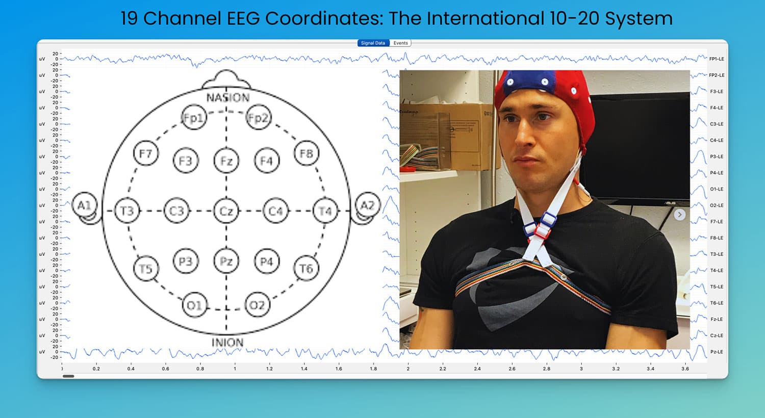 Biohacking with EEG Phenotypes: Predict Your Brain Function