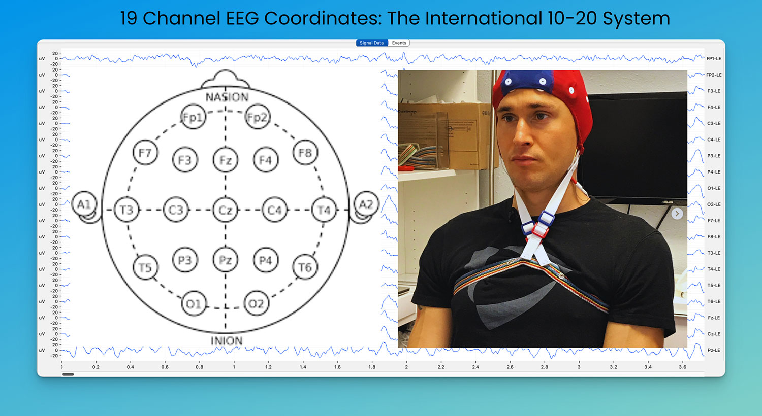 Biohacking with EEG Phenotypes: Predict Your Brain Function